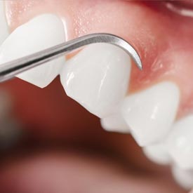 Dental Check-ups | Penhold Dental Care