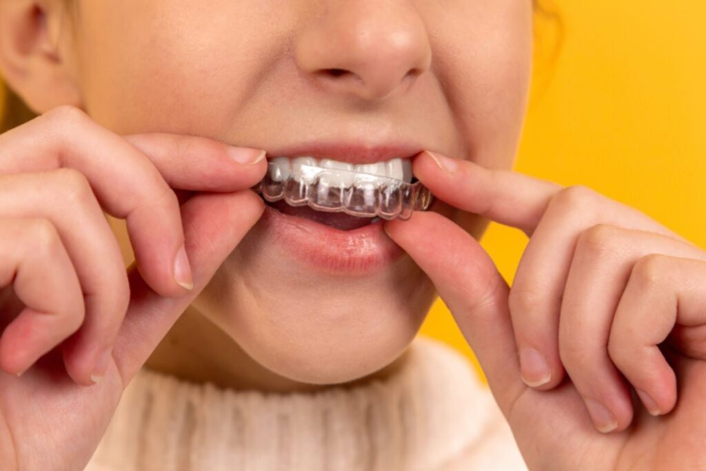 5 expert invisalign tips for a perfect smile